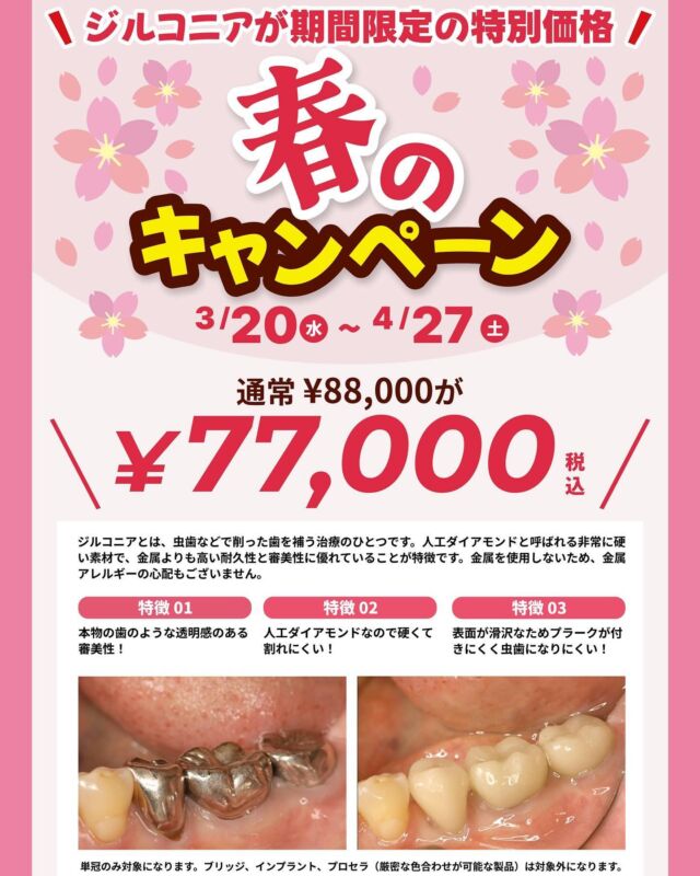 .
こんにちは😃
中央歯科医院です🦷

ジルコニアのキャンペーン実施のお知らせです📢

【3/20〜4/27】限定‼️
通常より1万円引きで硬くて綺麗なジルコニアが入れられます🦷
保険内で銀歯しか入れられないと言われた方、保険の白い物よりも丈夫で綺麗な物を入れたい方などにオススメしています。

※場合によって対象外あり（詳しくはご相談ください）
※保険外にはセラミックもございます
治療時にもご説明いたします。

#福島県　#いわき　#植田　#駅近　#中央歯科医院　
#歯科医院　#一般歯科　#予防歯科　#審美歯科　
#ホワイトニング　#インプラント　#セラミック　
#ジルコニア　#保険内診療　#自費診療　#歯周病　
#白い歯　#痛くない治療　#フッ素塗布
#スタッフ募集中　#歯科衛生士