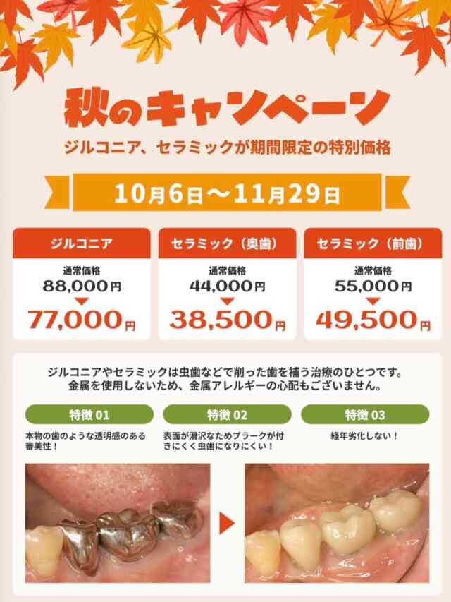 .
こんにちは😃
中央歯科医院です🦷

キャンペーン実施のお知らせです📢

【10/6〜11/29】限定！
通常よりお得に硬くて綺麗なセラミックとジルコニアが入れられます。🦷
保険内で銀歯しか入れられないと言われた方、保険の白い物よりも丈夫で綺麗な物を入れたい方、虫歯になりにくい物を入れたい方などにオススメしています。

※場合によって対象外あり（詳しくはご相談ください）
治療時にもご説明いたします。

#福島県　#いわき　#植田　#駅近　#中央歯科医院　
#歯科医院　#一般歯科　#予防歯科　#審美歯科　
#ホワイトニング　#インプラント　#セラミック　
#ジルコニア　#保険内診療　#自費診療　#歯周病　
#白い歯　#痛くない治療　#フッ素塗布
#スタッフ募集中　#歯科衛生士