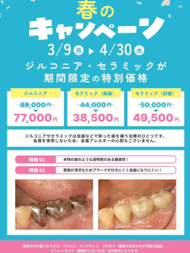 .
こんにちは😃
中央歯科医院です🦷

キャンペーン実施のお知らせです📢

【3/9〜4/30】限定！
通常よりお得に硬くて綺麗なセラミックとジルコニアが入れられます。🦷今回は前歯も適用です！
保険内で銀歯しか入れられないと言われた方、保険の白い物よりも丈夫で綺麗な物を入れたい方、虫歯になりにくい物を入れたい方などにオススメしています。汚れがつきにくいので口臭予防にも♪

※場合によって対象外あり（詳しくはご相談ください）
治療時にもご説明いたします。

#福島県　#いわき　#植田　#駅近　#中央歯科医院　
歯科医院　一般歯科　予防歯科　審美歯科　
ホワイトニング　インプラント　セラミック　
ジルコニア　保険内診療　自費診療　歯周病　
白い歯　痛くない治療　フッ素塗布
スタッフ募集中　歯科衛生士